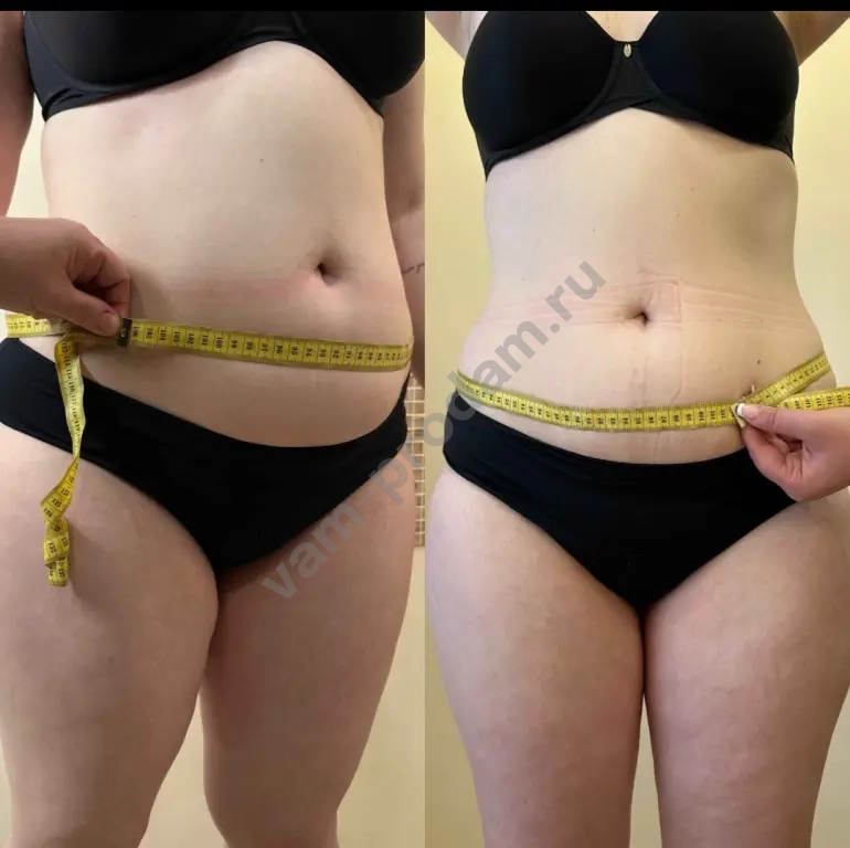 Модель на коррекцию фигуры