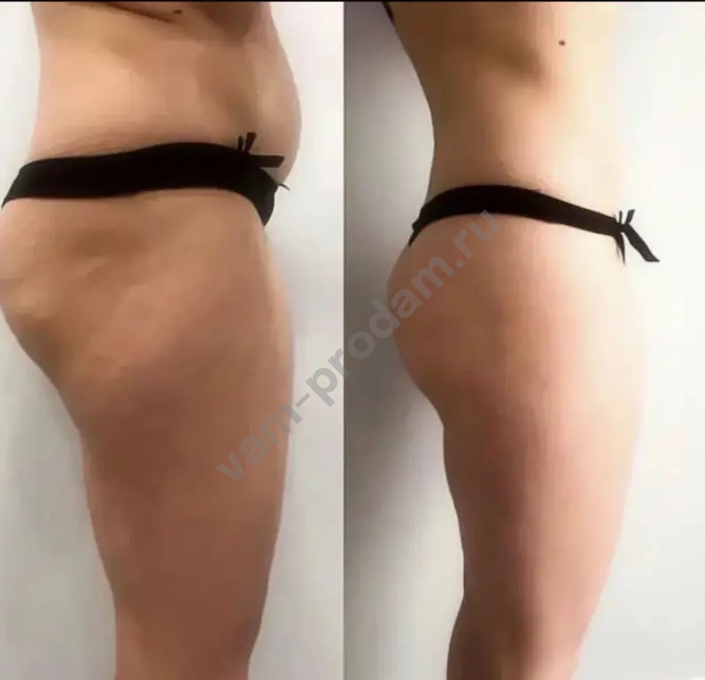 Модель на коррекцию фигуры