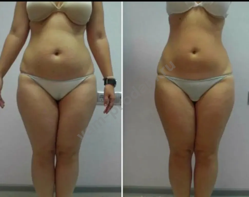 Модель на коррекцию фигуры