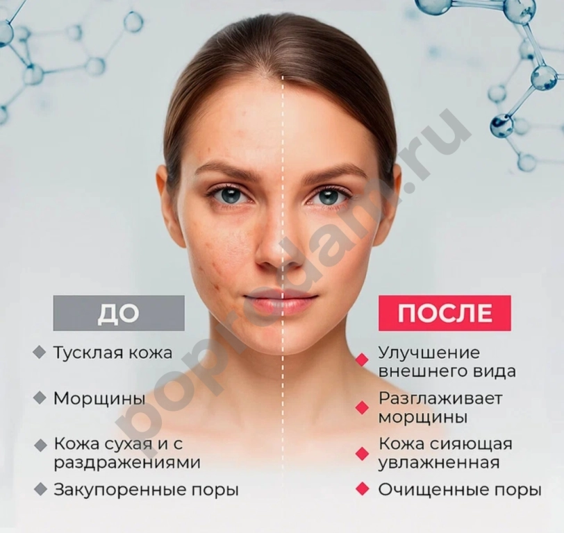 Пенка от акне Glycolite, 60 мл