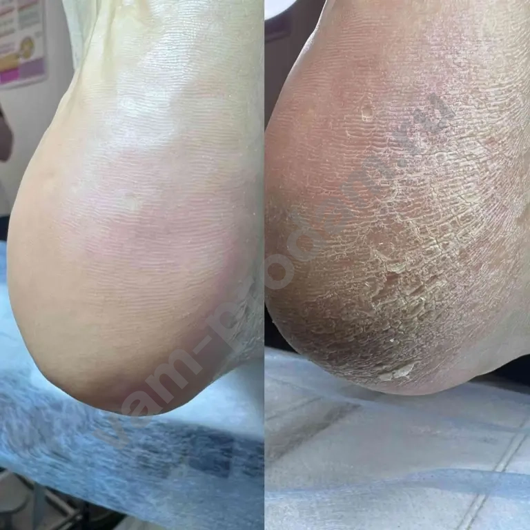 Мастер педикюра