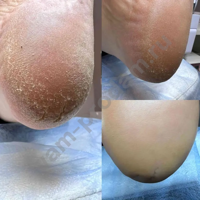 Мастер педикюра