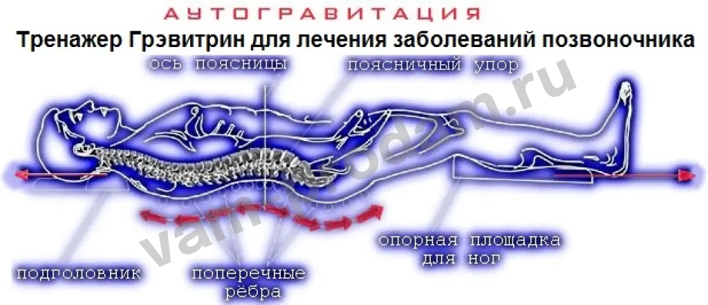 Лечение s-образного сколиоза позвоночника Тренажер Грэвитрин-комфорт плюс Вибромассаж спины