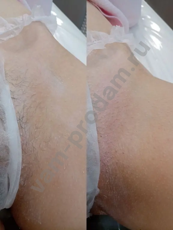 Мастер Депиляции/Эпиляции