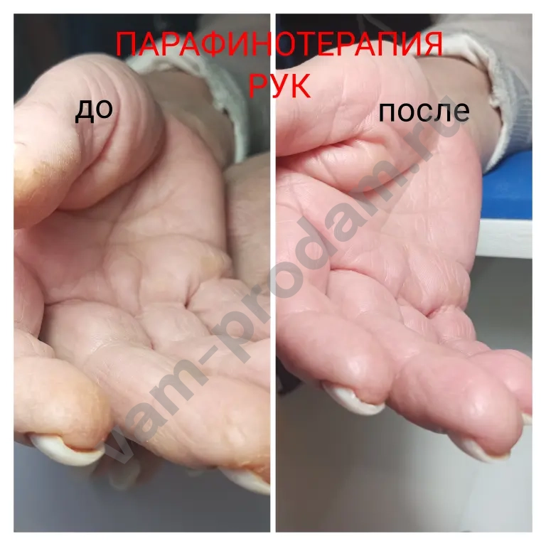 Маникюр, педикюр