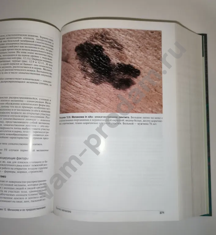 Дерматология Томас Фицпатрик 2007 г.