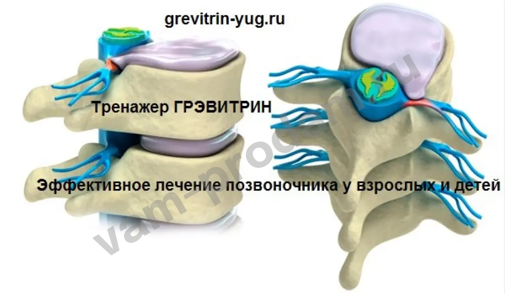 Тренажер "Грэвитрин-Комфорт плюс Вибромассаж" купить-заказать для лечения остеохондроза позвоночника