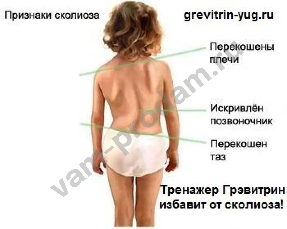 Лечение остеохондроза в домашних условиях цена